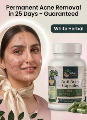 Anti Acne Capsules