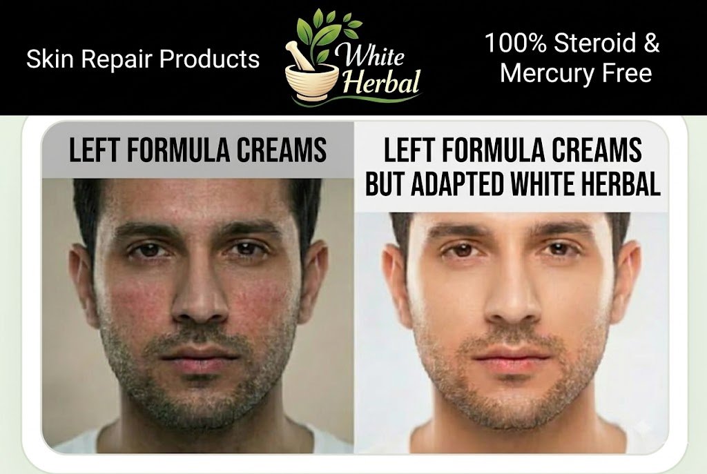 Before and after herbal skincare